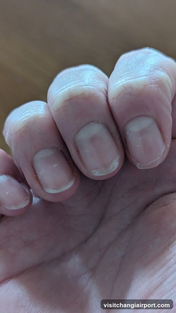 Hand with fingernails