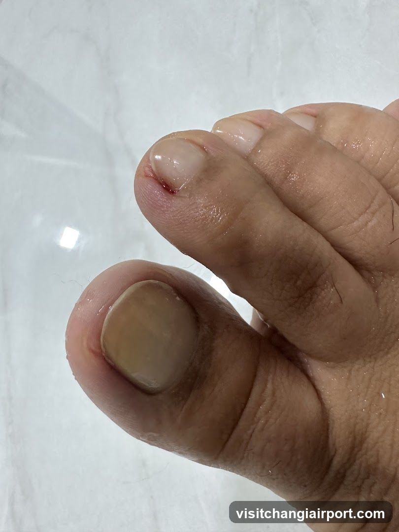 Foot with injured toe